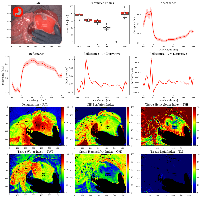 Organ profiles aggregated across the entire dataset.